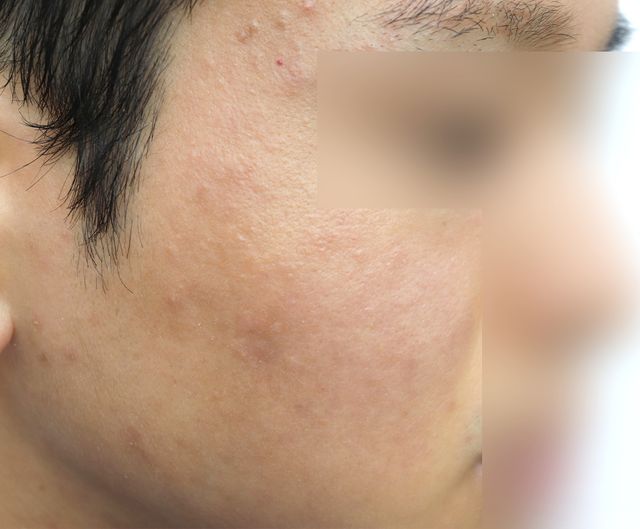 27세 남성 · 5개월 경과
